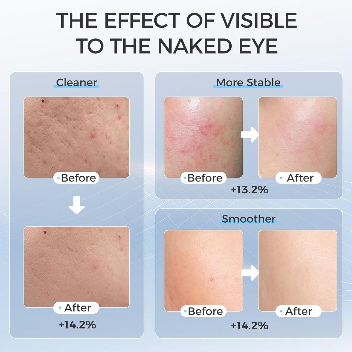 Máscara Facial LED con Terapia de Luz Roja para La cara y la Piel